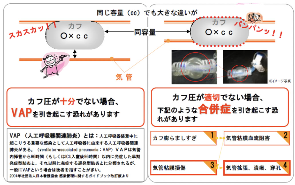 ソフィット カフインフレータ - MERA 泉工医科工業株式会社 ―医療 