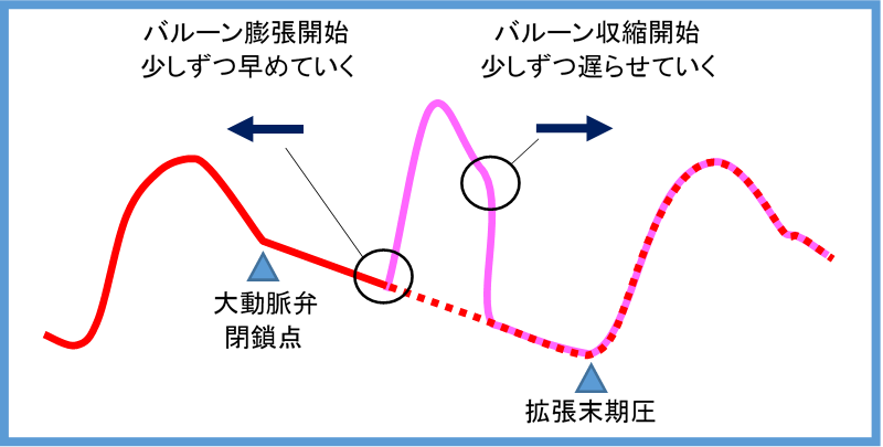 バルーン調整