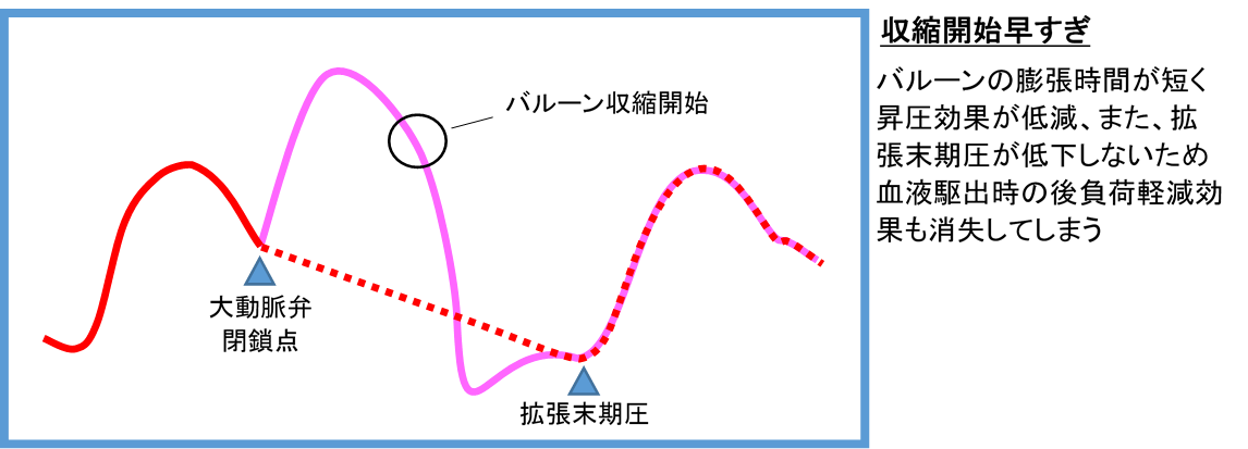 バルーン収縮タイミング早い