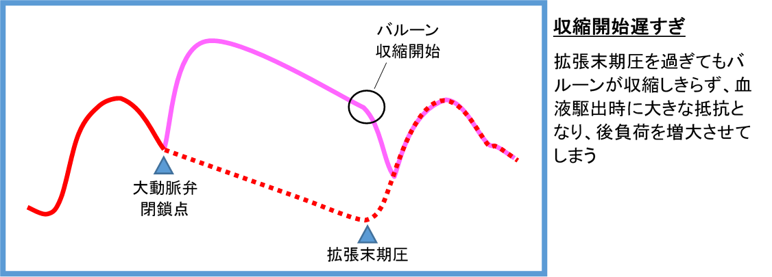 バルーン収縮タイミング遅い